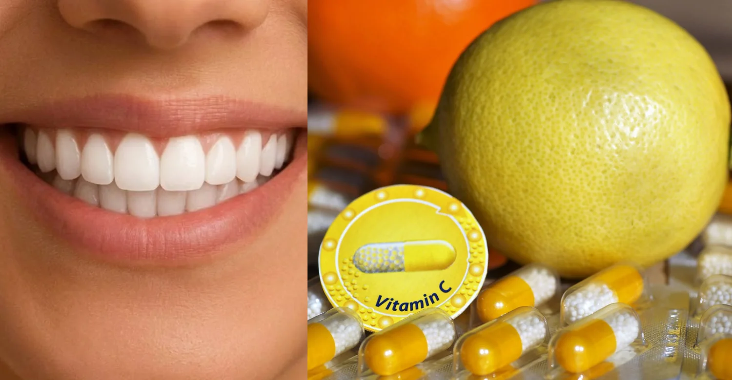 Vitamin C for Teeth 2